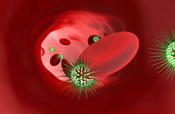 Symptômes d'empoisonnement du sang (Illustration: 123RF, D. Kotin) Si la fièvre augmente ou si des frissons se développent, vous devez consulter un médecin.