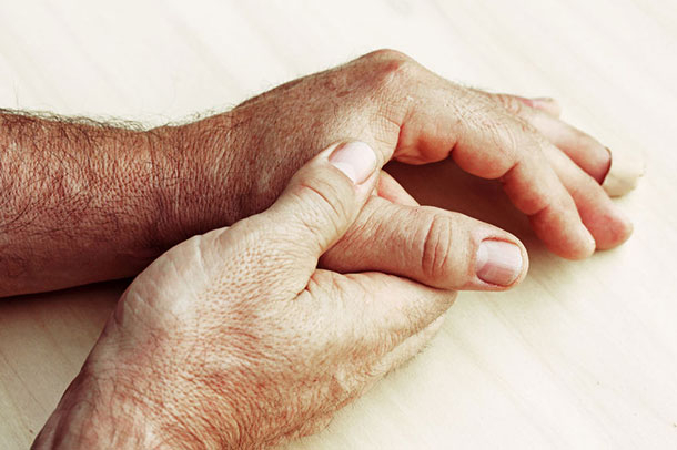 Psoriasis-Arthritis: Schmerzhafter Begleiter der Schuppenflechte (Foto: 123RF, Astrid Gast) Psoriasis: Schmerzhafter Begleiter der Schuppenflechte. (Foto: Im Fokus Männerhände. Die Einte Hand hält das Daumengelenk der Anderen. 123RF, Astrid Gast)